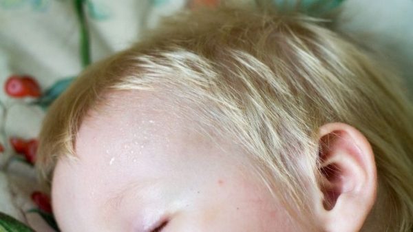 Bebeklerde Terleme Neden Olur?