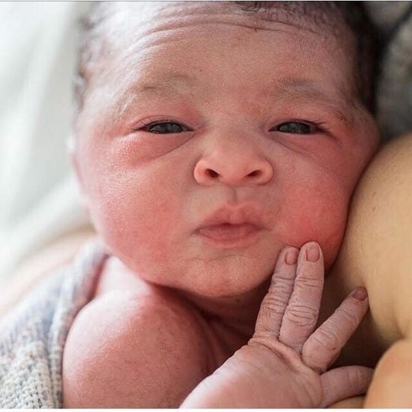 Yenidoğan Bebeğin Burnu Neden Tıkanır?